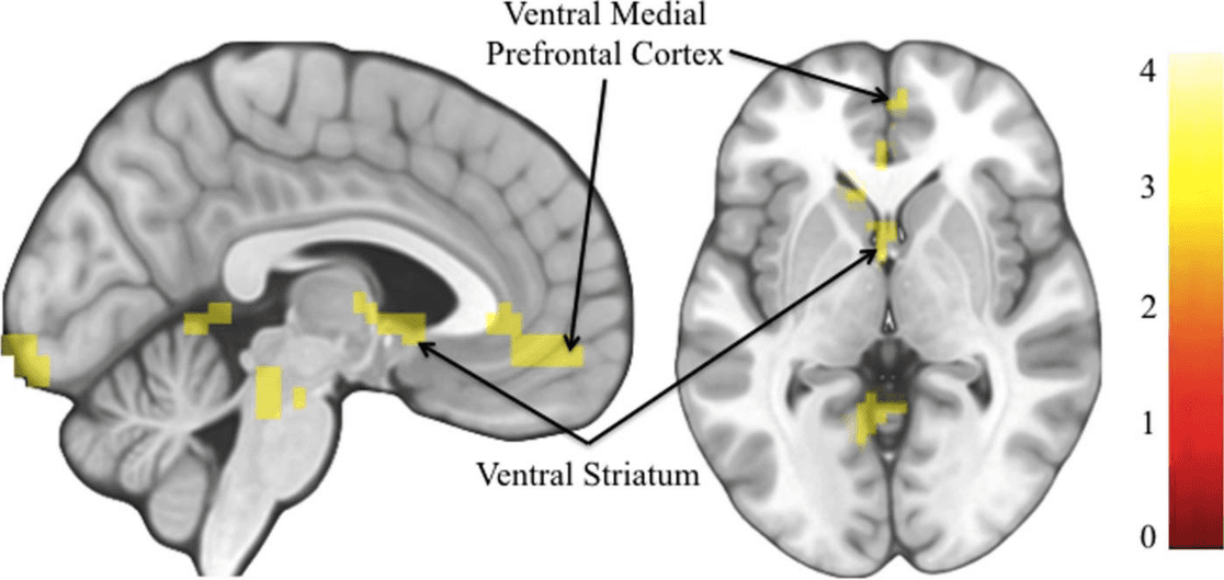Brain Hack: Future Thinking Rewires Your Motivation