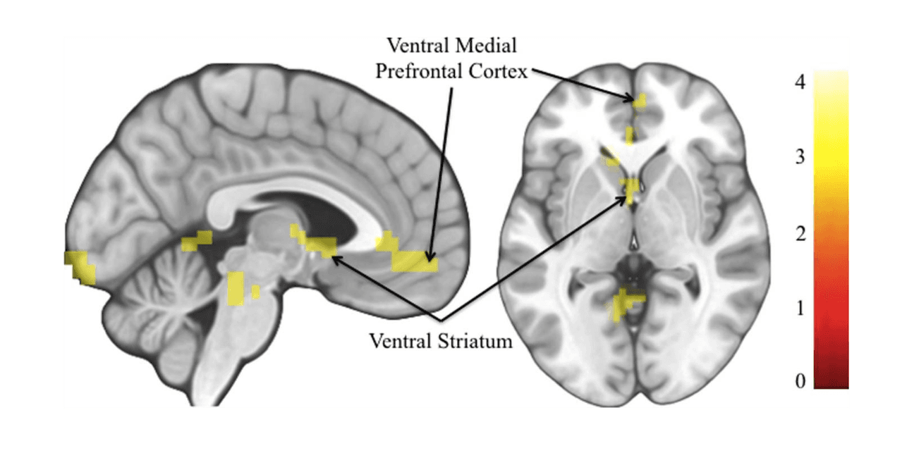 Brain Hack: Future Thinking Rewires Your Motivation